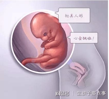 体外受精 IVF-ET